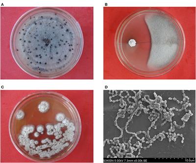 Identification and genomic analyses of a novel endophytic actinobacterium Streptomyces endophytica sp. nov. with potential for biocontrol of yam anthracnose